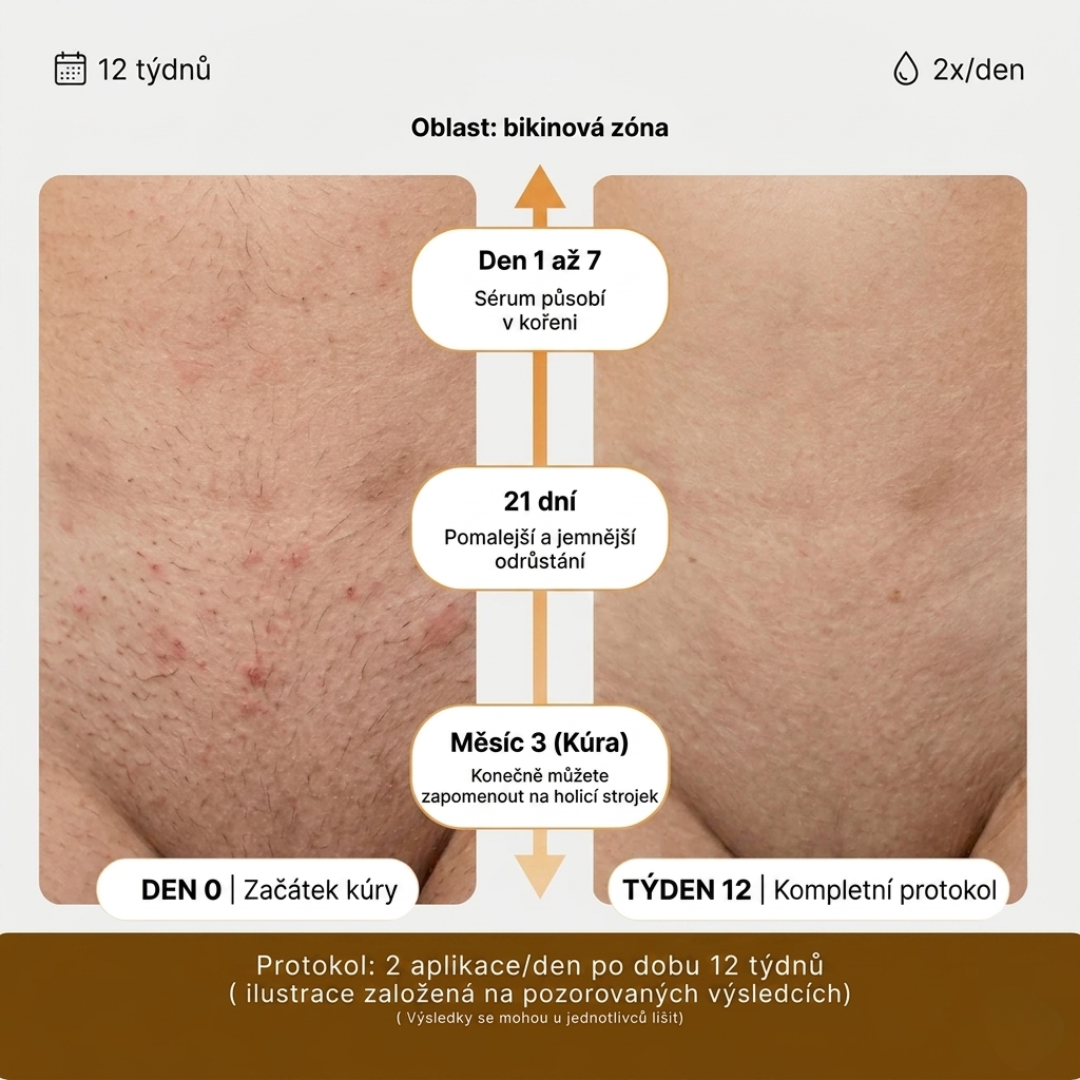 Přírodní sérum proti zarůstání chloupků
