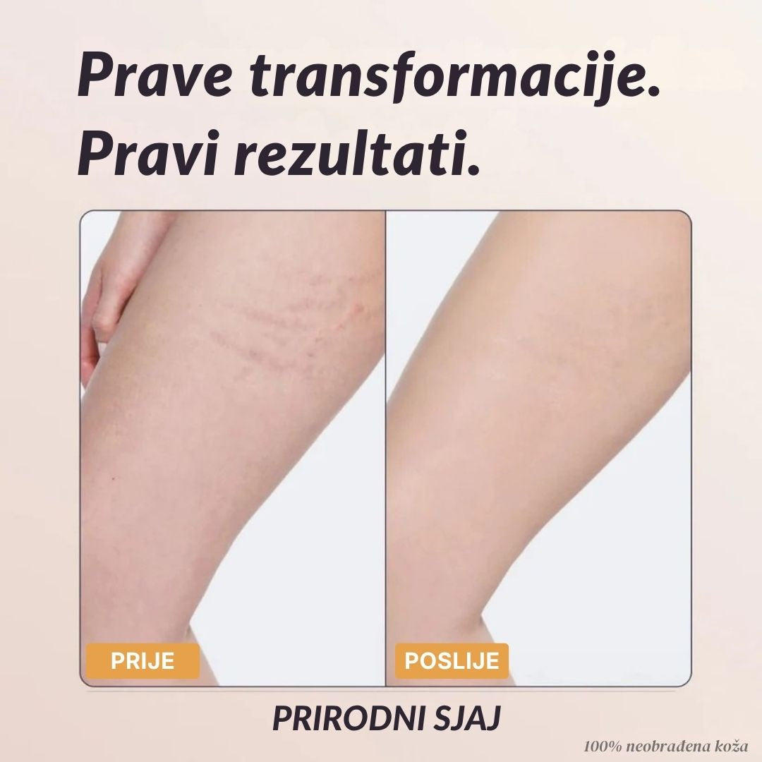 Lorvea Trenutni Korektor za Tijelo