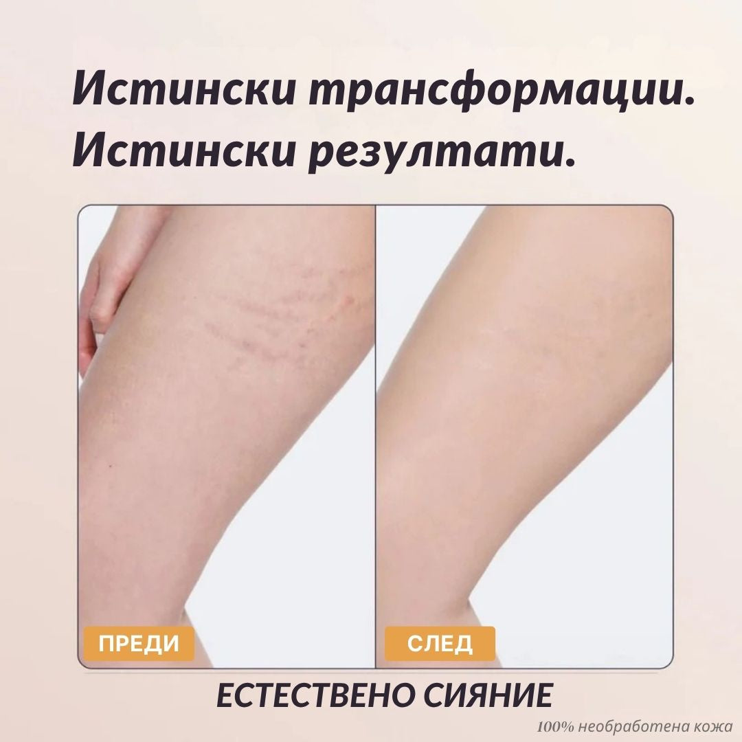 Lorvea Незабавен Коректор за Тяло