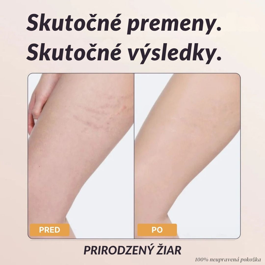 Lorvea Okamžitý Telesný Korektor