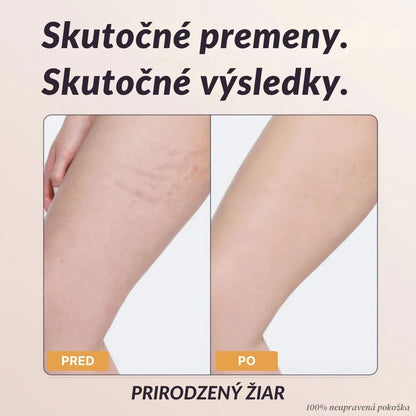 Lorvea Okamžitý Telesný Korektor