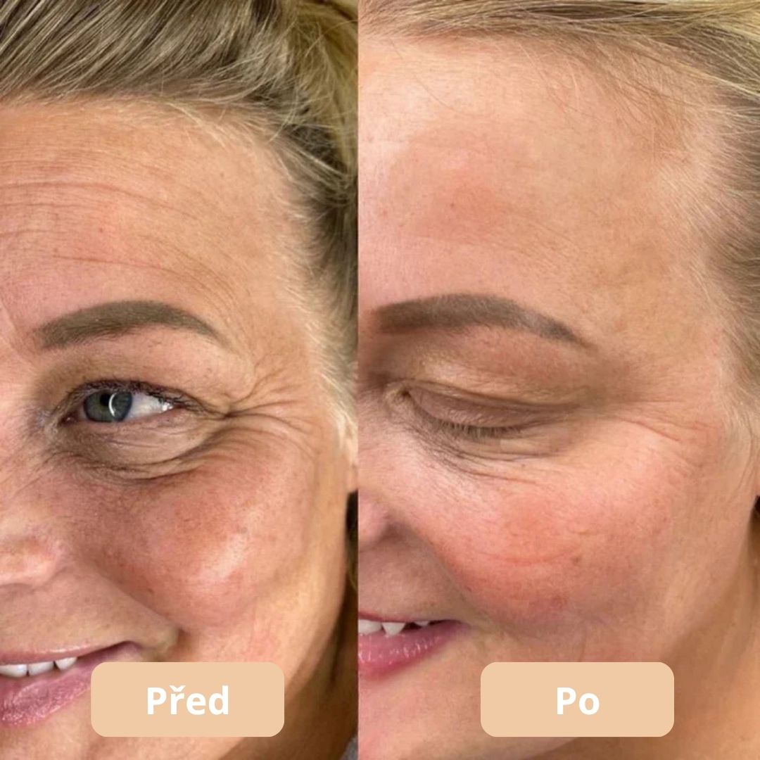 Lorvea™ Kompletní Vápníková Sada pro Péči o Pleť