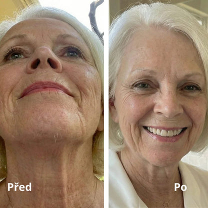 Lorvea Cyperus — Olej proti růstu chloupků