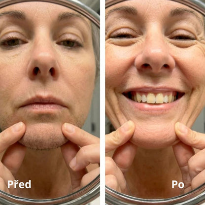 Lorvea Cyperus — Olej proti růstu chloupků